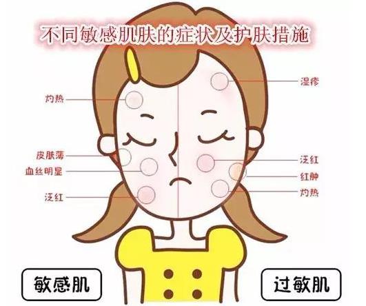 68348cefb946595b12576bcd5f250c06230220.jpg 图片2.jpg