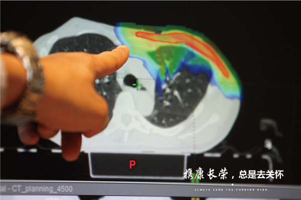 出国看病：西达-赛奈医疗中心颅内肿瘤治疗体验