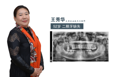 廊坊广播电视台全程报道即刻种植牙直播