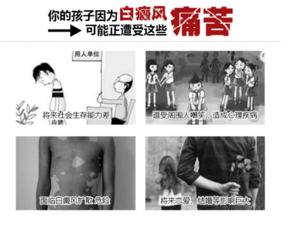 合肥北大白癜风医院9月 ▏开学季·祛白变形计