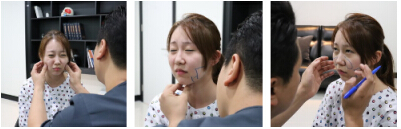【韩国轮廓整形实录】徐范信帮忙从O脸到V脸，并不需磨骨！