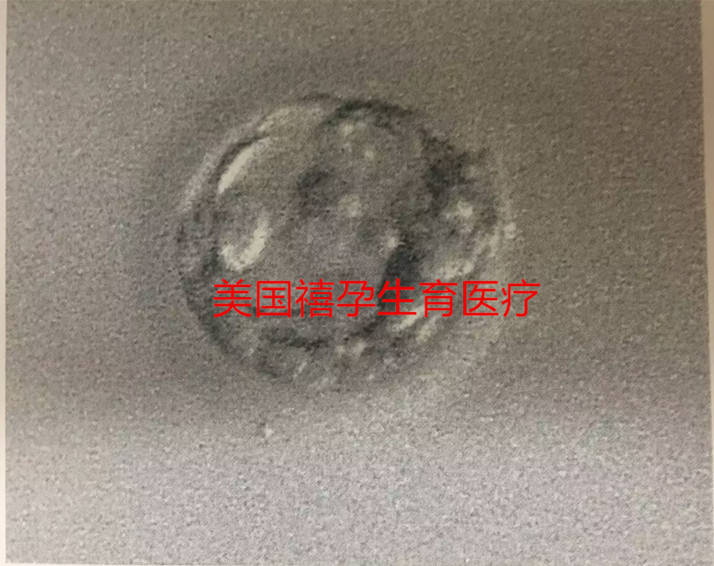 分享点美国试管婴儿小知识，大龄女性 赴美试管前应这么做