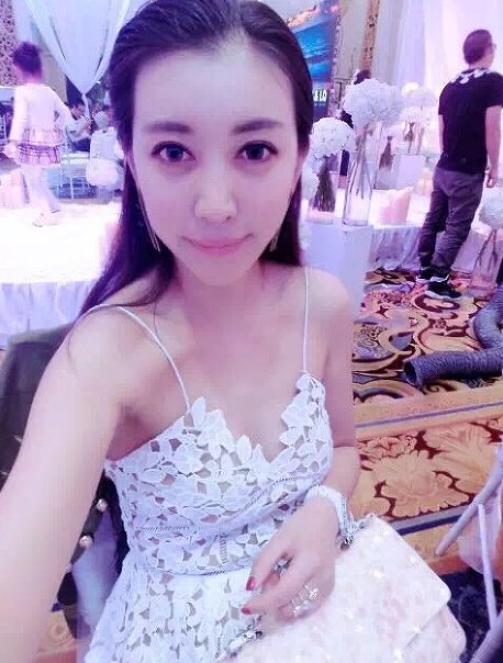 我变美终极秘诀——王明利CGF脂肪移植