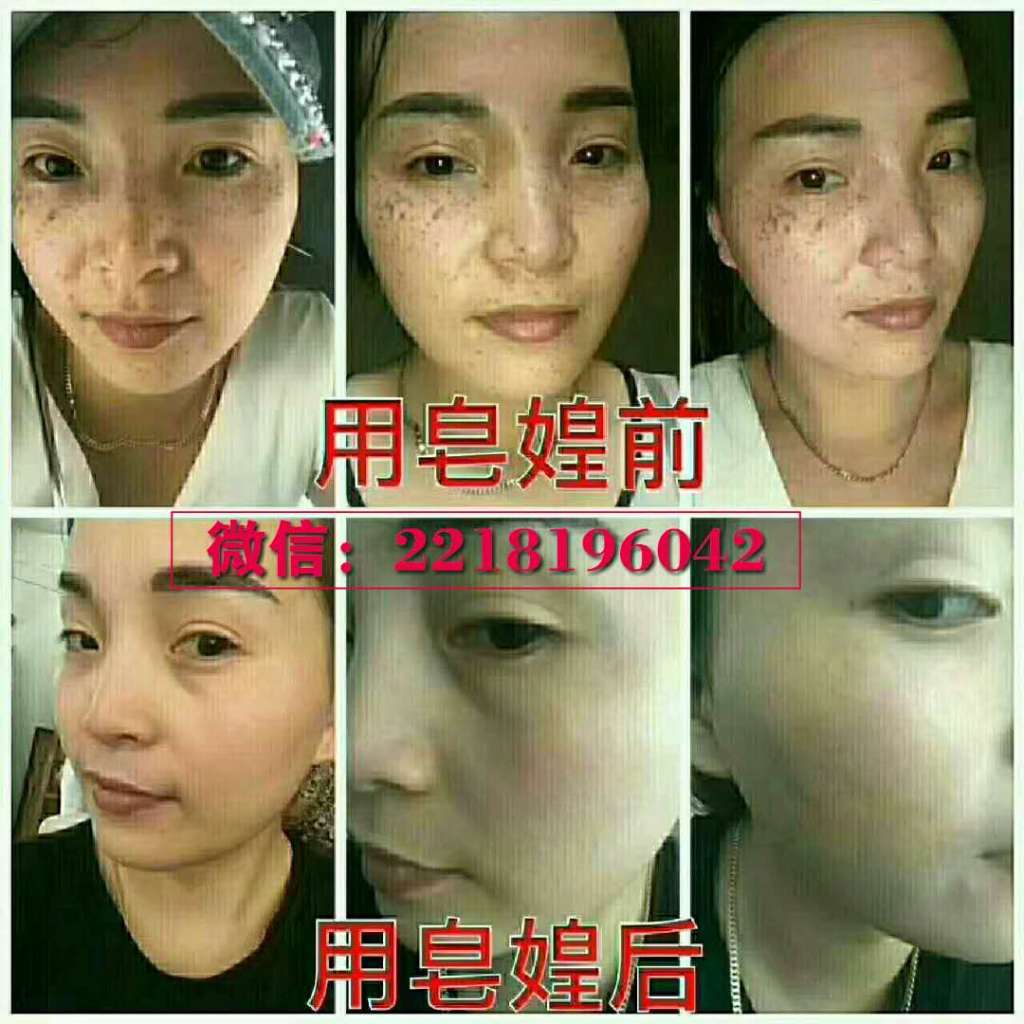 满婷皂可以用来洗脸吗？可以美白吗？效果怎么样？总代静静招代理