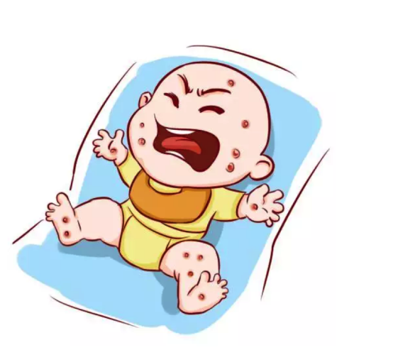 婴儿奶癣怎么治疗？这些方法一看就会