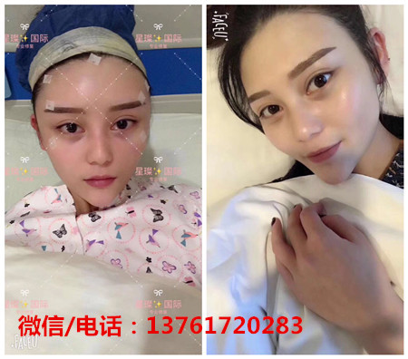 星璨国际整容招代理吗？联系方式是多少？