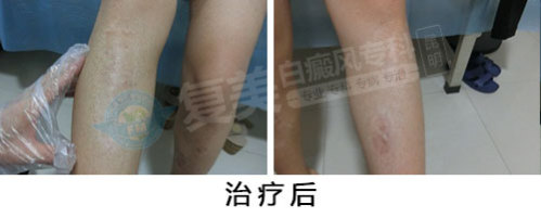 后.jpg