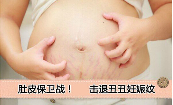 如何去除妊娠纹 这个去妊娠纹方法不可错过